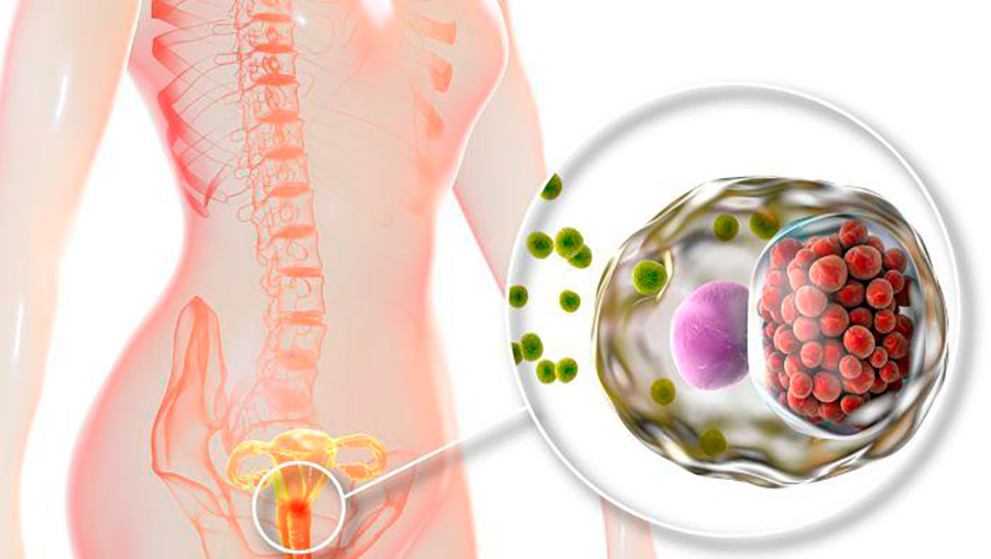 Consulta por infecciones recurrentes